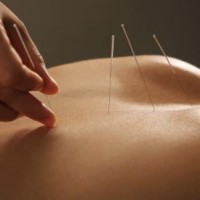 Akupunktur giver resultater uden bivirkninger