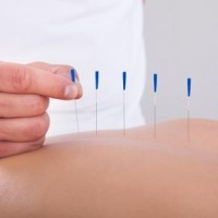 Akupunktur kan hjælpe, hvor traditionelle behandlinger svigter